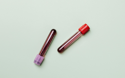 Screening Blood Tests: What they Measure and Why it’s Important